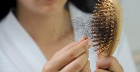 perdita capelli donna